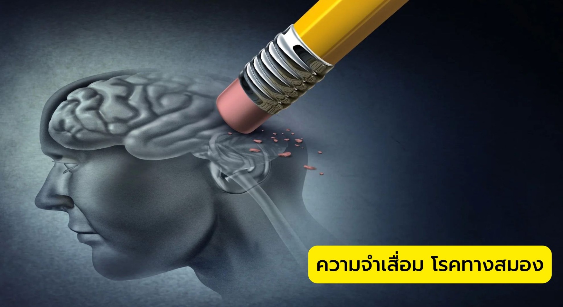 ความจำเสื่อม โรคทางสมอง