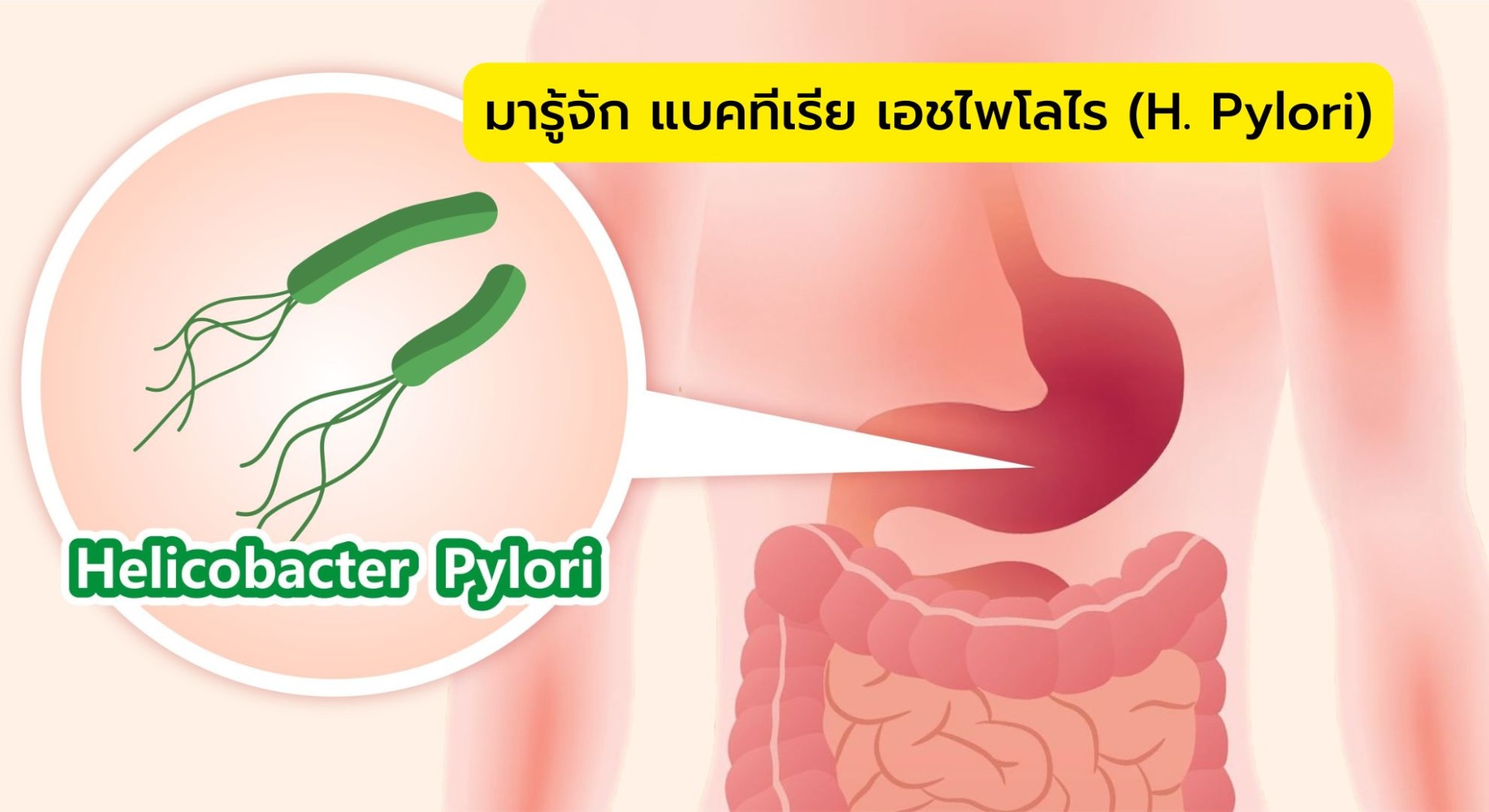 มารู้จัก แบคทีเรีย เอชไพโลไร (H. Pylori)