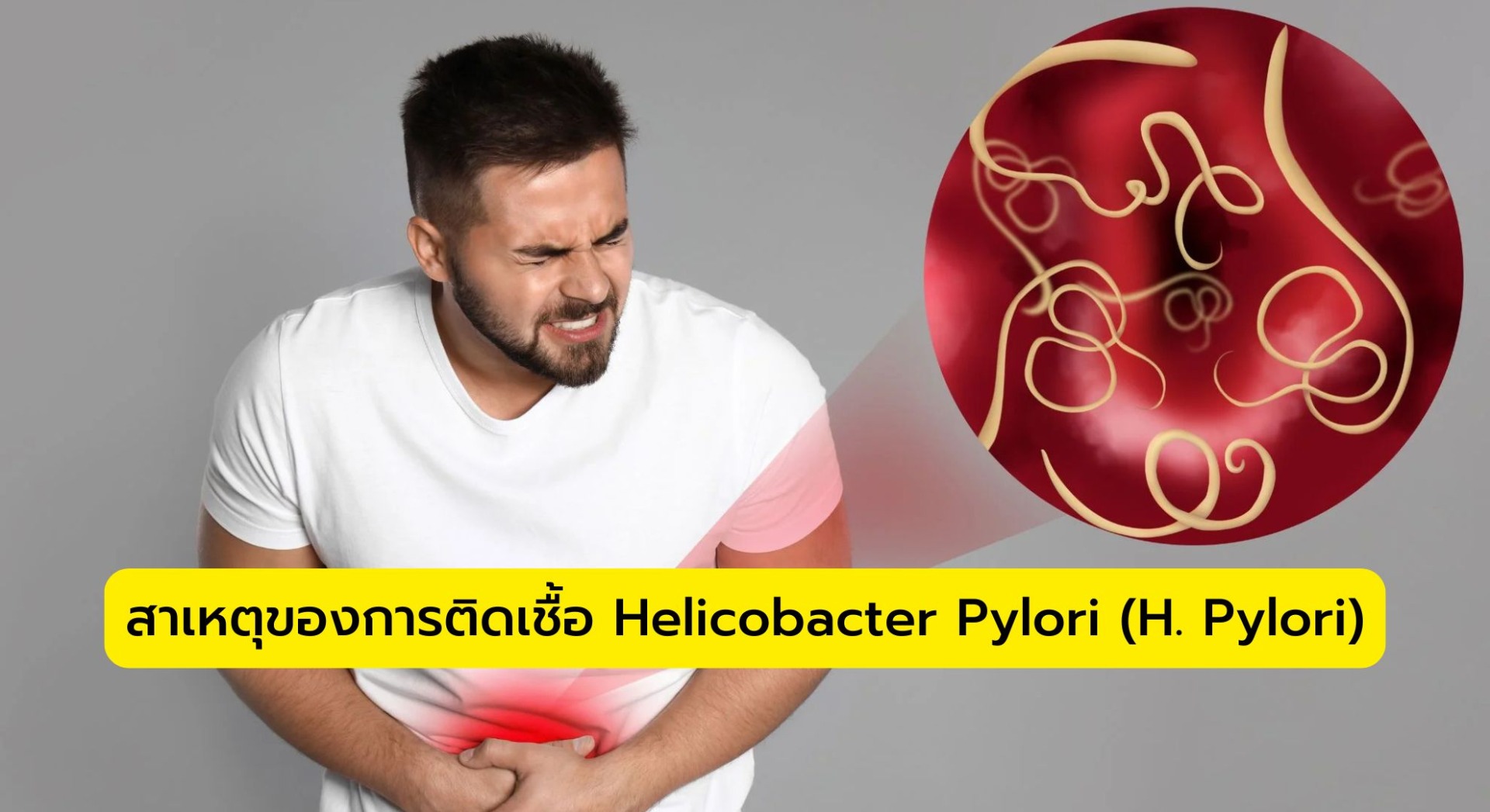 สาเหตุของการติดเชื้อ Helicobacter Pylori