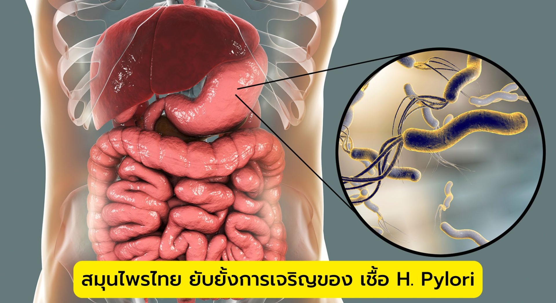 สมุนไพรไทย ยับยั้งการเจริญของ เชื้อ H. Pylori