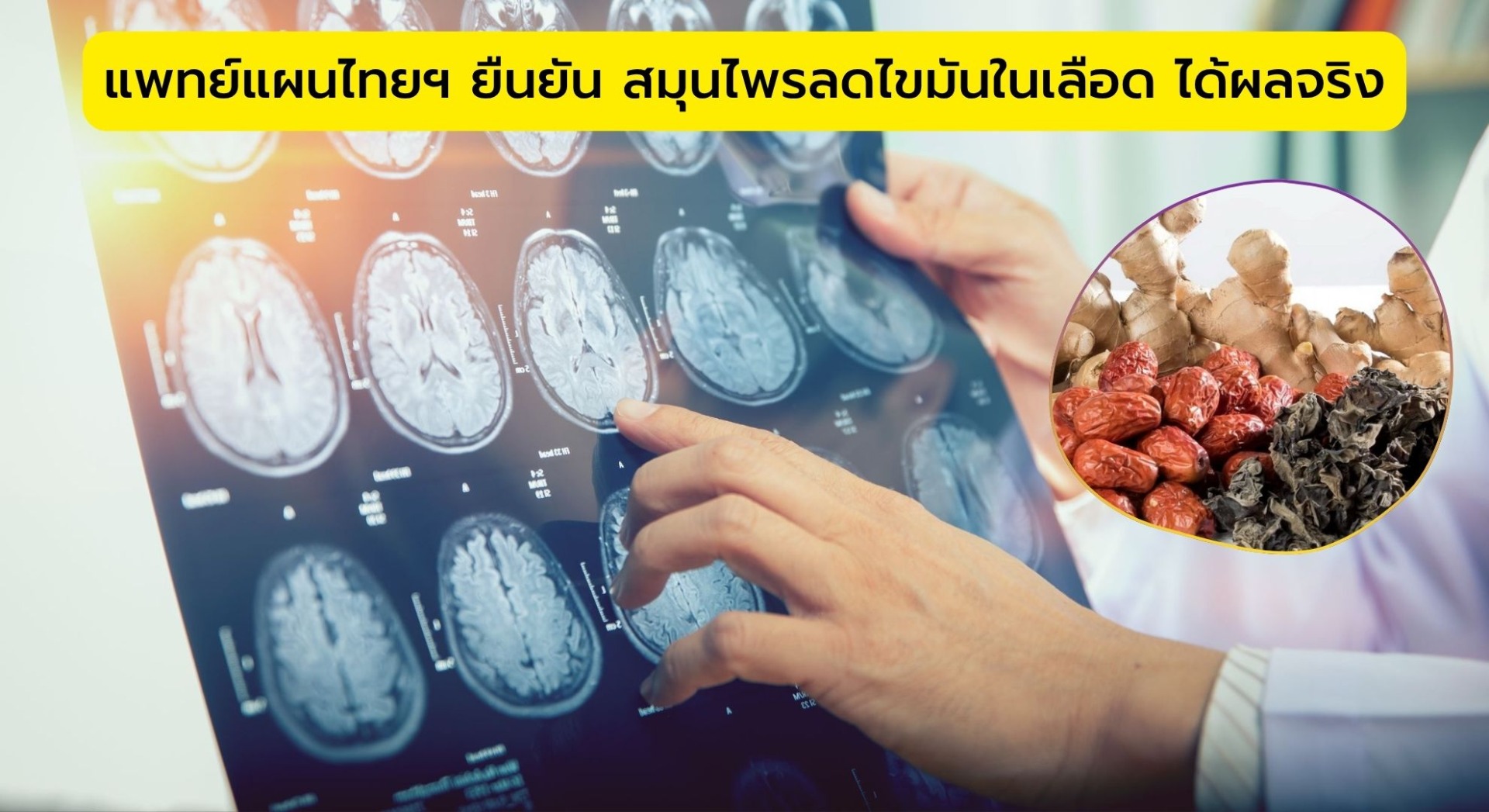 แพทย์แผนไทยฯ ยืนยัน สมุนไพรลดไขมันในเลือด ได้ผลจริง