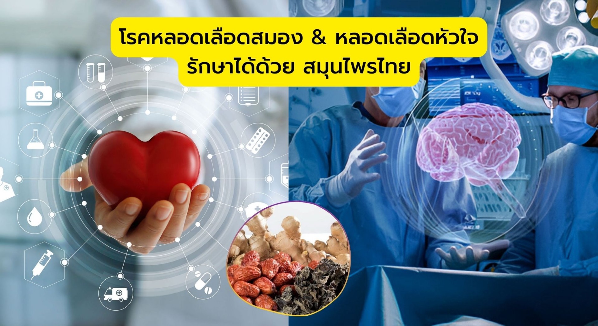 โรคหลอดเลือดสมอง & หลอดเลือดหัวใจ รักษาได้ด้วย สมุนไพรไทย