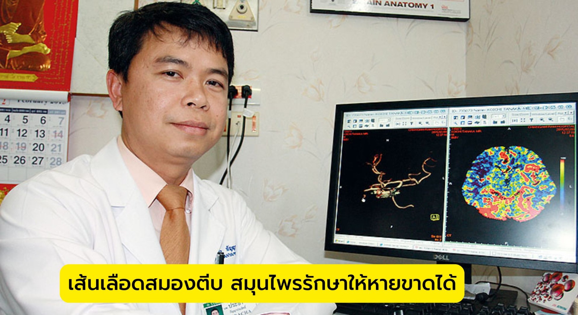 เส้นเลือดสมองตีบ สมุนไพรรักษาให้หายขาดได้
